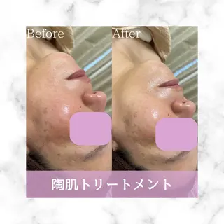 セミロング カラー パーマ ヘアアレンジ メンズ キッズ ネイル マツエク・マツパ アイブロウ Amaryllis 🌹松本のエステ・リラクイメージ