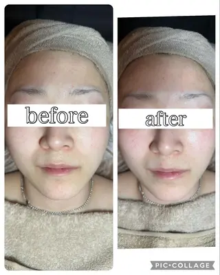 エステ✖️ネイル Feelのネイルデザイン