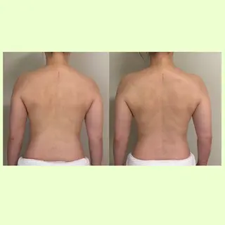 リラクゼーションスパ　ひのき所属・spaHINOKI 【女性専用】のエステ・リラクイメージ