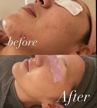 beauty lanaのエステ・リラクイメージ