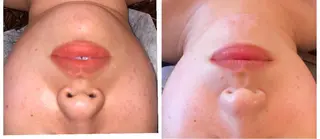 FLEUR大阪・整体 ・ハイフ・痩身・小顔のエステ・リラクイメージ