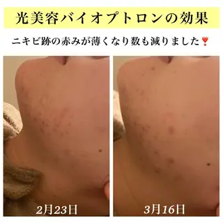 Bellesthe (ベルエステ)のエステ・リラクイメージ