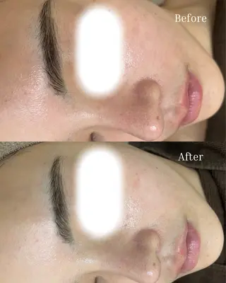 BELLIS HUIT所属・体質｜肌質改善ꕤ BELLISHUITのその他イメージ