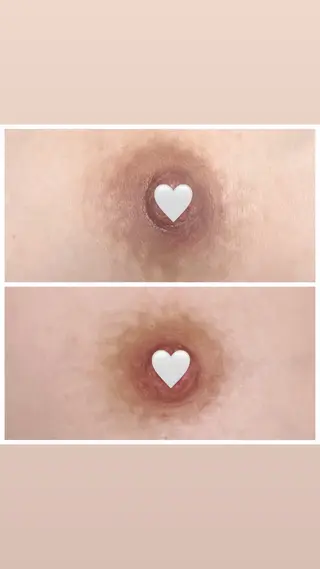 本気で痩せたい方へ 痩身専門サロンのその他イメージ