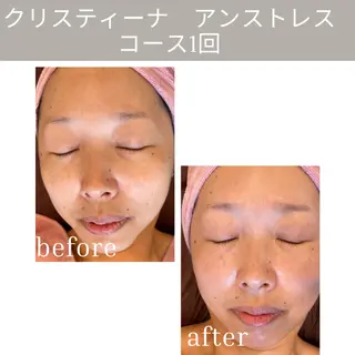 肌質改善エステ chiffonのエステ・リラクイメージ