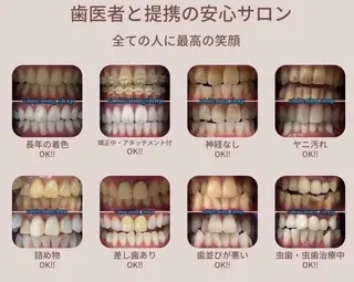 メンズ ホワイトニング ショップ船橋２号店のエステ・リラクイメージ