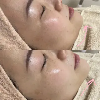 アイブロウ&フェイシャルサロンa‘lm所属・WAX脱毛/肌質改善 眉毛とお肌のサロンのエステ・リラクイメージ