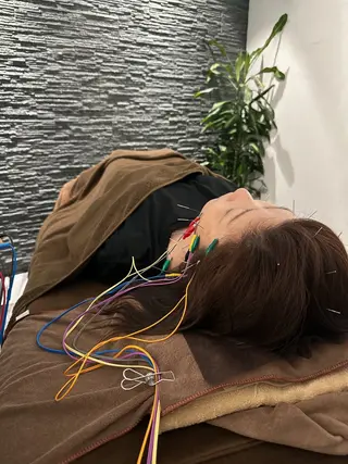 美容鍼灸整体サロンBeauJu所属・小顔矯/美容鍼/鍼灸 BeauJuのその他イメージ