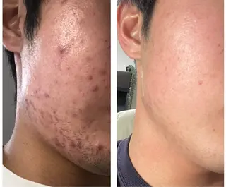 耳ツボ/体質改善/ 温活La mer月島のその他イメージ