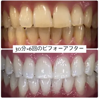 PLATINUM Beauty 横浜店所属・ホワイトニングルーム 横浜店のその他イメージ