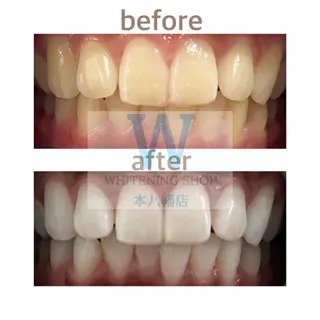 ホワイトニング ショップ本八幡店のエステ・リラクイメージ