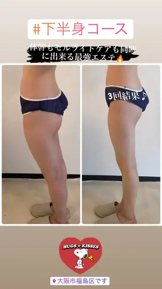 FLEUR大阪・整体 ・ハイフ・痩身・小顔のエステ・リラクイメージ