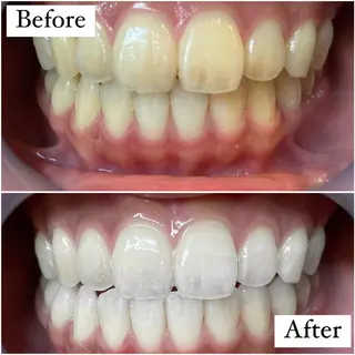 LBSホワイトニング 🌐渋谷店 小河原のエステ・リラクイメージ