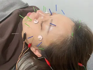 メディカルサロンドオフ所属・ハリサロンドオフ 美容鍼灸×小顔整体のエステ・リラクイメージ