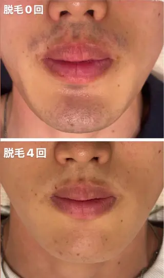 TotalBeautySalon UNCHEL所属・Ito ayakaのその他イメージ