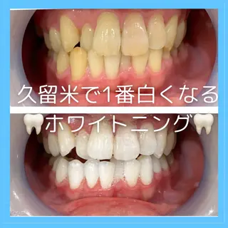 Monreve所属・美人スイッチdiet スーパージェクションのその他イメージ