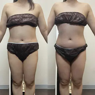 ハイパーナイフ専門店 Salon de COCO所属・Salon de COCOのエステ・リラクイメージ