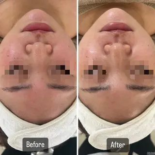 脱毛＆Beauty salon IILA所属・肌管理/HBL専門店 Sakuraの眉毛・アイブロウイメージ