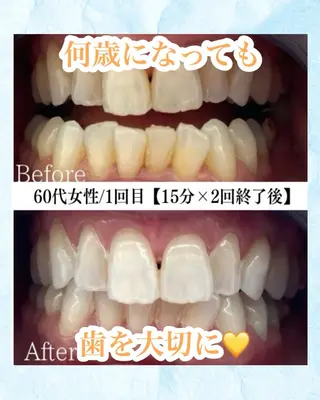 メンズ キッズ ホワイトニング専門店 WHITE天神店のエステ・リラクイメージ