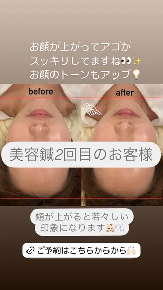 美容鍼/鍼灸 ここみ鍼灸院のエステ・リラクイメージ