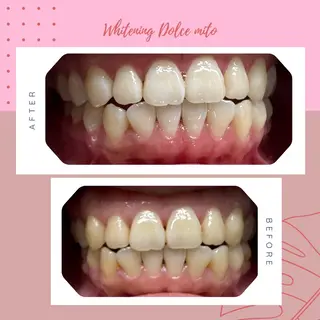 セルフホワイトニング Dolce水戸店のその他イメージ