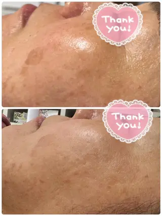 Lien オーナー　山口智嘉のエステ・リラクイメージ