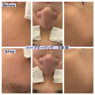 ぱんだ王国エステ所属・ぱんだ王国 エステのエステ・リラクイメージ