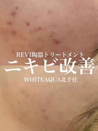 WHITE AQUA 北千住店のエステ・リラクイメージ