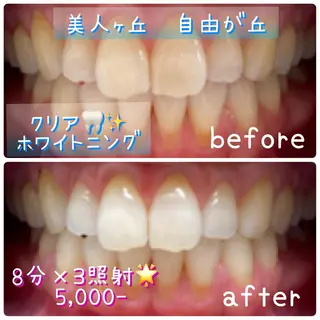 韓国/ヌーディー系 ネイル自由が丘のネイルデザイン