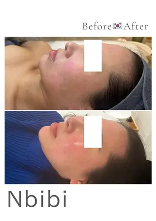 韓国🇰🇷価格 サロン_Nbibiのエステ・リラクイメージ