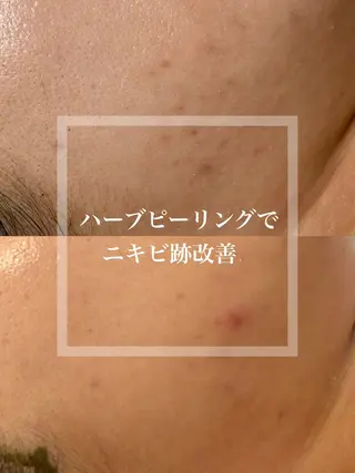 WHITE AQUA 北千住店のエステ・リラクイメージ