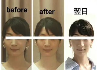 小顔と美肌 まごころエステMatoria所属・小顔 美肌専門 Matoriaのエステ・リラクイメージ