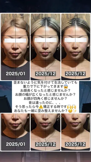 💎後悔させない小顔 矯正💎イトヤマ🌱のエステ・リラクイメージ