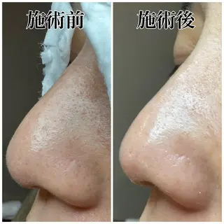 目元と毛穴の専門店　kawamura所属・かわむら ゆりのマツエク・マツパデザイン