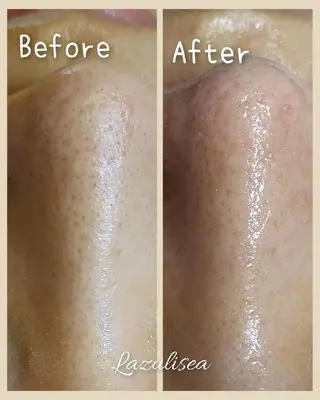 エステサロン Lazulisea所属・川口 春奈のエステ・リラクイメージ