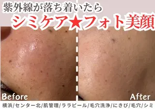 sii センター北 AIのエステ・リラクイメージ