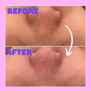 Lily luce 美骨小顔矯正のその他イメージ