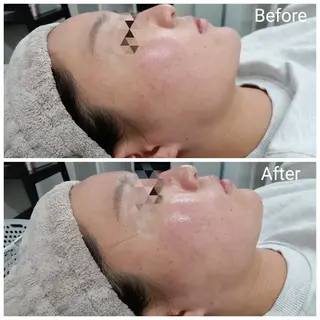 肌質改善Beauty salon Renのエステ・リラクイメージ