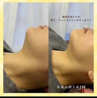 ナスサロ️ 看護師️🫧山口のエステ・リラクイメージ
