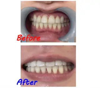 セルフホワイトニングサロン　ラヴィアン所属・ホワイトニングサロン La vie enのその他イメージ