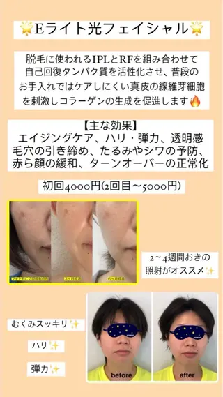 脱毛サロンwillow所属・脱毛サロン Willow /棚村のエステ・リラクイメージ