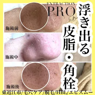 epismoo 脱毛/HBL/毛穴の眉毛・アイブロウイメージ