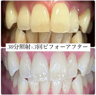 PLATINUM Beauty 横浜店所属・ホワイトニングルーム 横浜店のその他イメージ