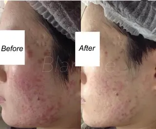 ショート カラー パーマ ヘアアレンジ キッズ ネイル マツエク・マツパ 都度払い肌質改善 &脱毛Blancheのエステ・リラクイメージ