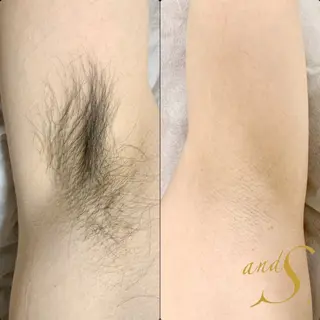 🌸🧡六本木 脱毛しずか🧡🫧の眉毛・アイブロウイメージ