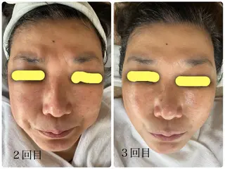 エル美容室所属・oshima yuukiのマツエク・マツパデザイン