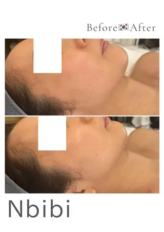 韓国🇰🇷価格 サロン_Nbibiのエステ・リラクイメージ