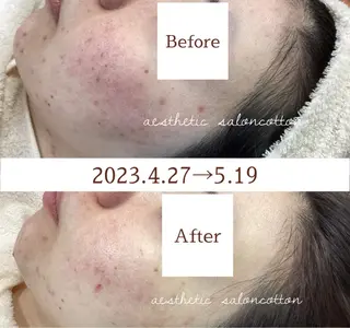 都度払い 肌質改善専門サロンのエステ・リラクイメージ