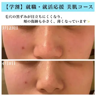 Bellesthe (ベルエステ)のエステ・リラクイメージ