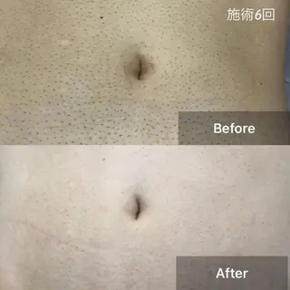 毛穴洗浄・痩身・脱毛 /アルカンジュのエステ・リラクイメージ